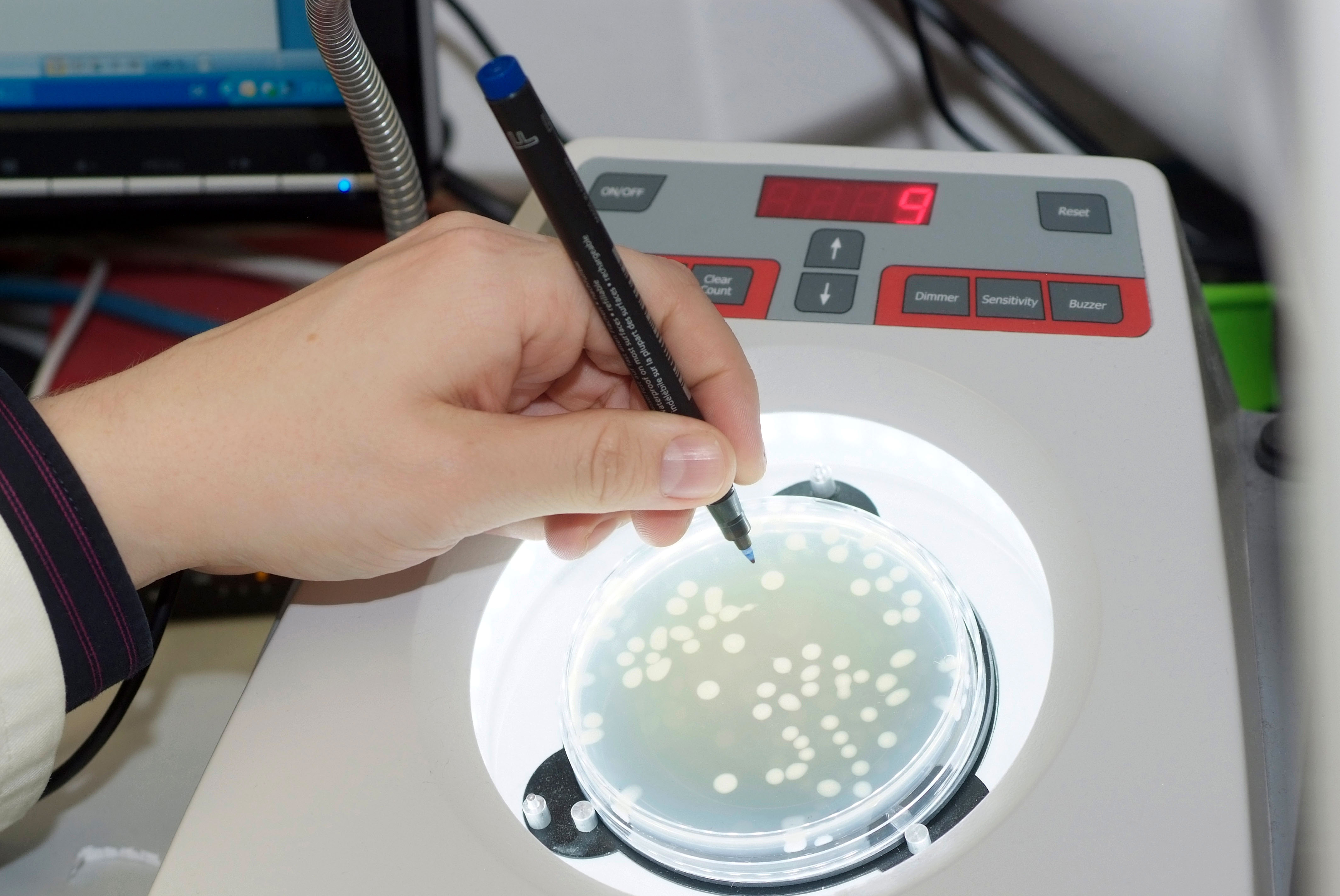 The photo shows a Petri dish with bacterial cultures and a hand holding a pen.
