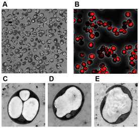 Fünf vergrößerte Fotos der Cyanobakterien, drei davon als einzelne Zellen. Hier ist das produzierte PHB als großer, weißer Fleck gut zu erkennen.