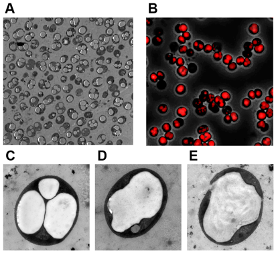 Five enlarged photos of the cyanobacteria, three of them as single cells. Here the produced PHB is well visible as a large white spot.