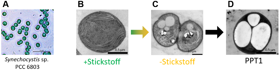 Vier Fotos von mikroskopisch vergrößerten Cyanobakterien, in der Zelleinschlüsse, und vor allem PHB zu erkennen sind.