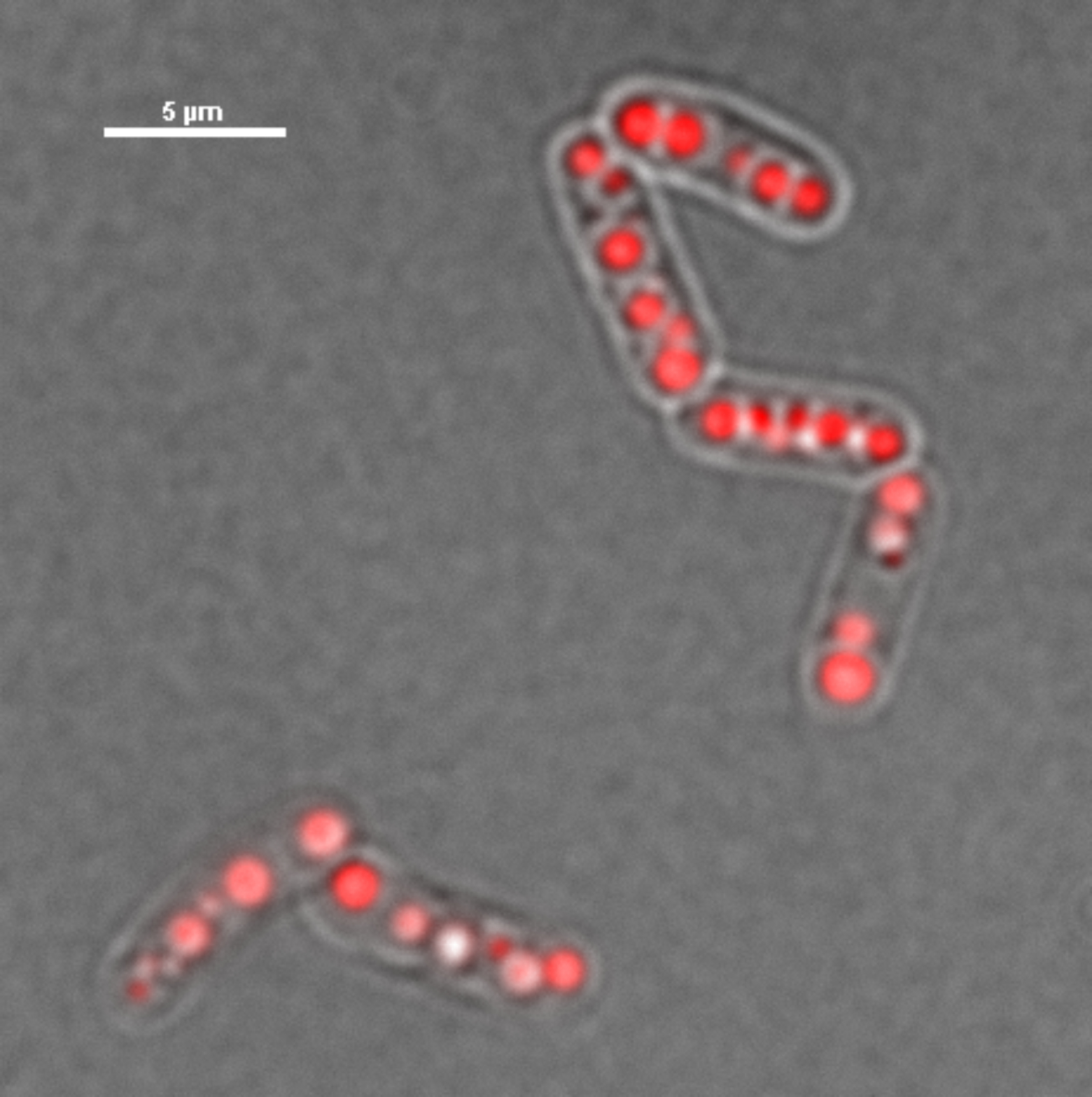 Microscopic image of a chain of four and a chain of two elongated bacteria, in which large, rounded granules that are stained with Nile red can be seen.