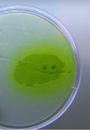 Zellen, die auf einer Kulturplatte wachsen. Die Zellen sind etwas dunkler als der Rest der Platte. Da UV-Licht auf die Zellen fällt, fluoreszieren sie durch die Pyoverdine grün.