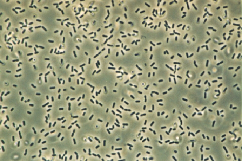 Bacillus subtilis ist in der Biotechnologie bereits etabliert. Bakterien könnten die Basis der biotechnologischen Kunststoffproduktion werden. (Foto: Wikipedia)