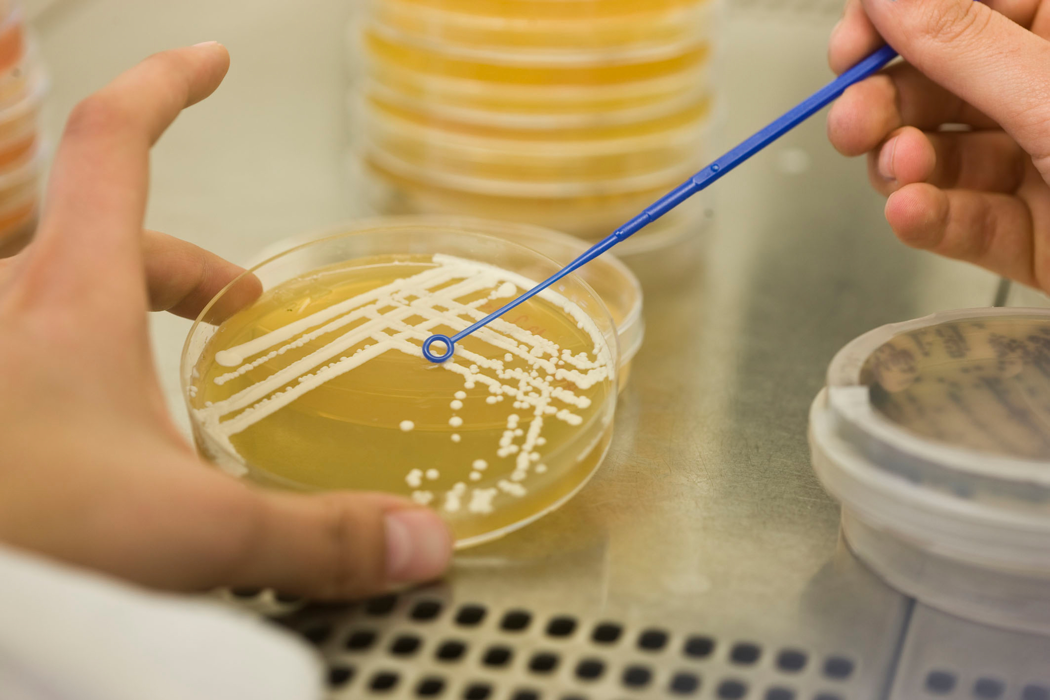 Bacterial culture in a Petri dish