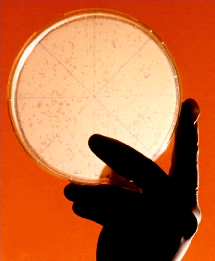 Eine Hand mit Handschuhe hält eine Petrieschale auf der Mikroorganismen gewachsen sind.