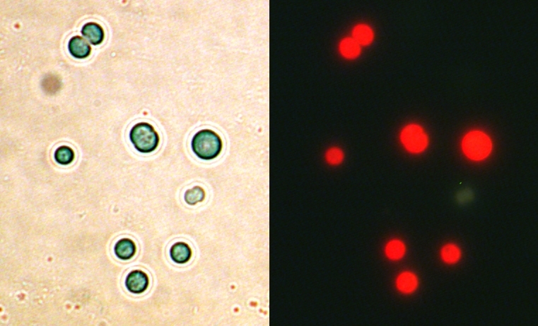 Zu sehen sind einzelne Bakterien, mit dem Mikroskop aufgenommen und rot fluoreszierend