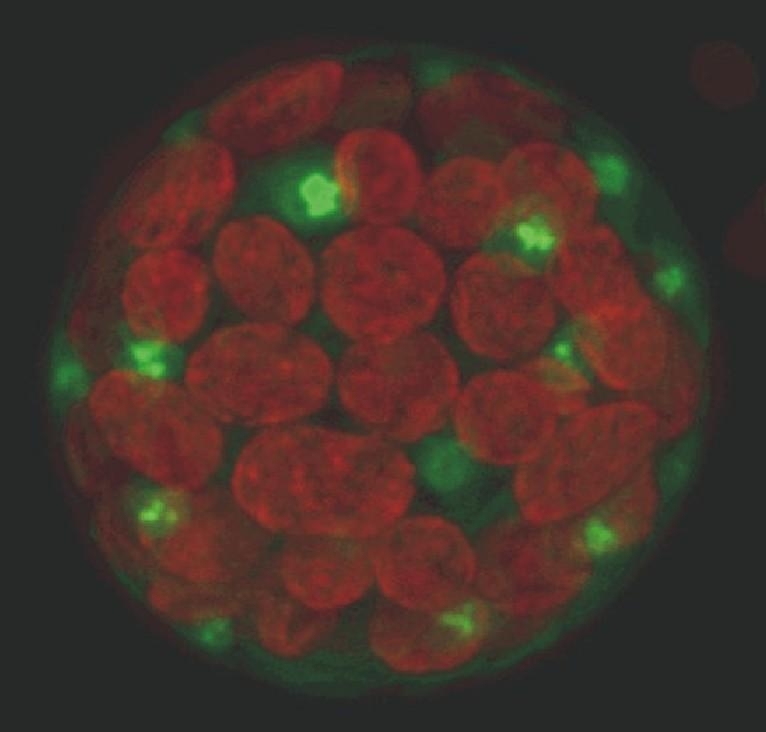 By coupling the calcium ATPase gene to the GFP gene (green fluorescent protein), the researchers identified the position of the ion pump in the moss cell. Chloroplasts (red), membranes of the small ATPase-containing vacuoles (green).