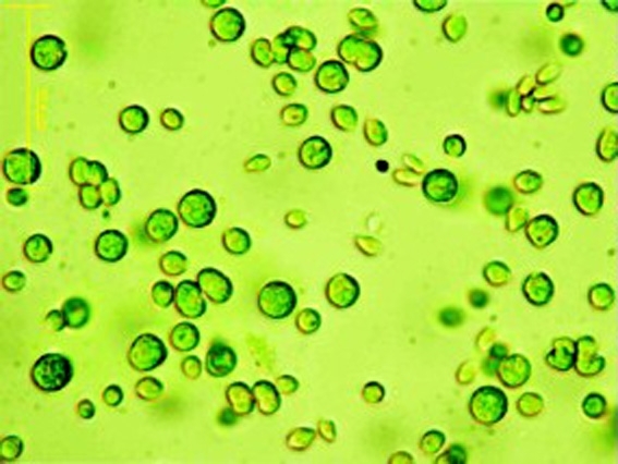 Mikroskopische Aufnahme von Mikroalgen, die Algen erscheinen als kleine grüne Kreise vor hellgrünem Hintergrund