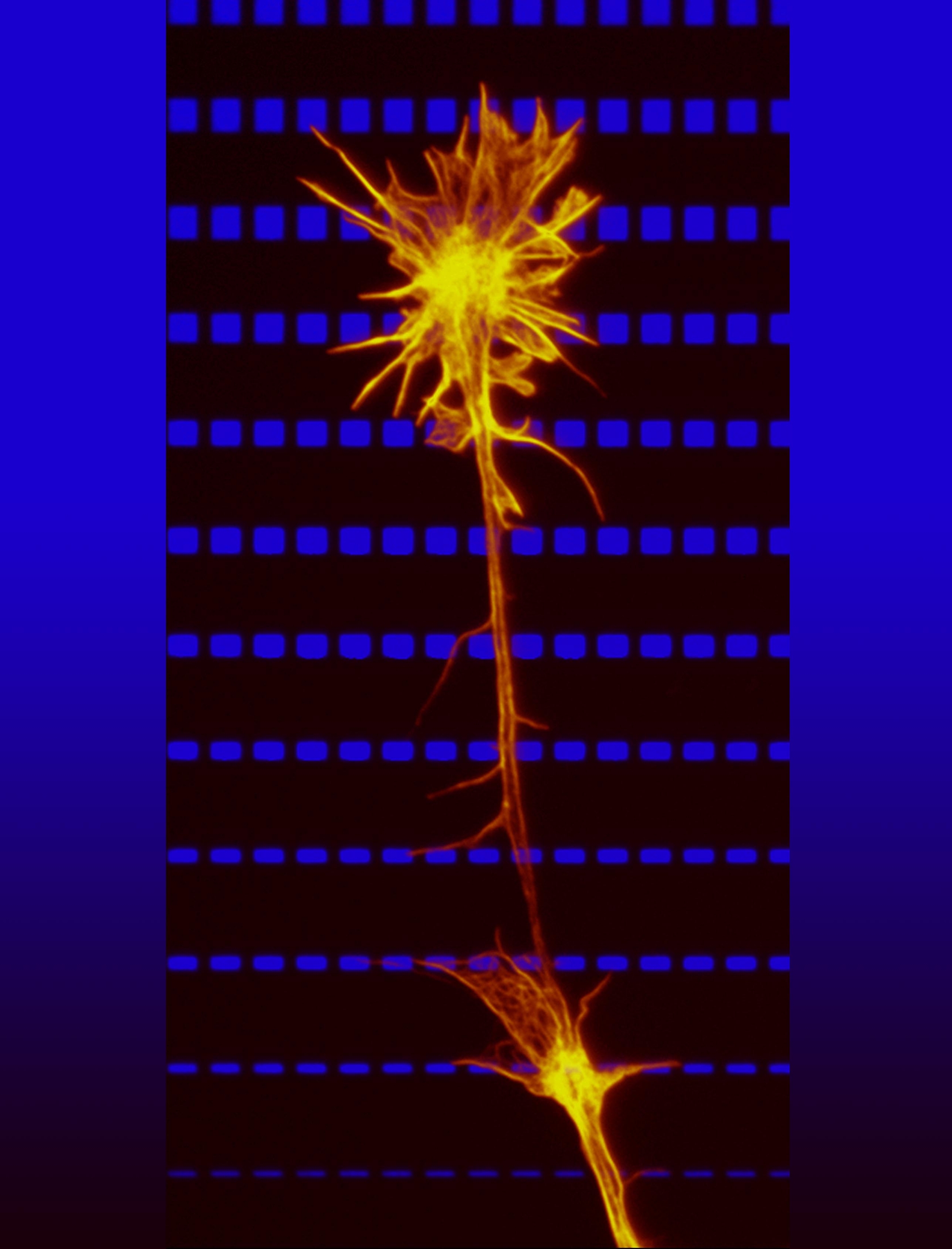 Zu sehen ist ein horizontales blau-schwarzes Streifenmuster. Auf diesem Hintergrund ist ein goldenes Neuron mit einem Axon zu sehen.