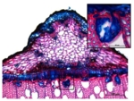 Zu sehen ist eine mikroskopische Aufnahme von rot und blau gefärbtem Zellengewebe.