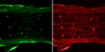 Zu sehen sind zwei konfokalmikroskopische Aufnahmen des gleichen Teils einer Pflanzenwurzel. Das linke Bild zeigt die Lokalisation des Proteins SP7 in den Zellkernen dank GFP. Das rechte Bild zeigt die Verteilung aller Proteine über den gesamten Zellraum.