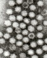 Schwarz-weiße elektronenmikroskopische Aufnahme einiger Viruspartikel.