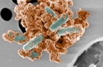 Electron microscope image of iron-oxidising bacteria surrounded by rust particles.