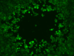 Microscopic image of plaque formation by HSV1 viruses (green fluorescing).