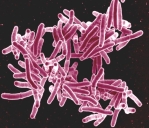 The photo shows a collection of pink-coloured, elongated bacteria against a dark background