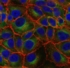 Fluoreszenz-gefärbte Leberkrebszellen